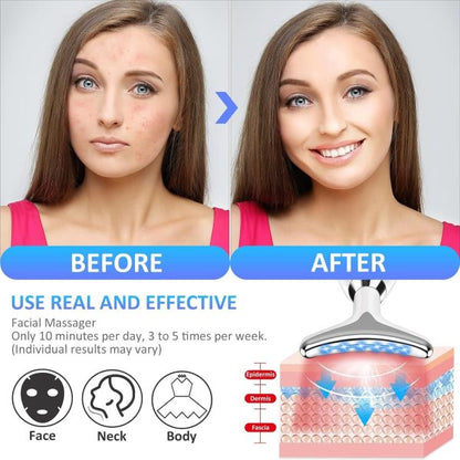 Es-1081 Massager Intense Pulsed Light Wrinkles Reducing Instrument – Esx – Anti Ageing & Reduces Puffiness | Face Massager For Fine Line & Wrinkles – Random Color